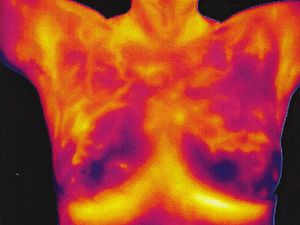 Thermogram--color